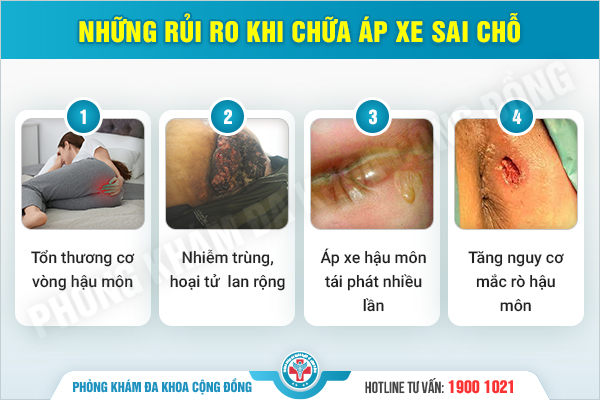 Phương Pháp Điều Trị Áp Xe Hậu Môn Theo Tiêu Chuẩn Y Khoa Mới Nhất 2025